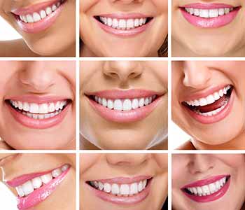 Cosmetic dentist in Orland Park, IL area offers variety of procedures