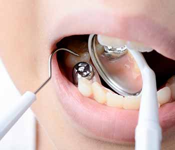 Burr Ridge, IL area dentist offers safe removal of mercury