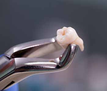 Dr. Janet S. Stopka is a dentist in the Burr Ridge, IL area who is here to help patients in understanding the tooth extraction process so there are no surprises from start to finish!