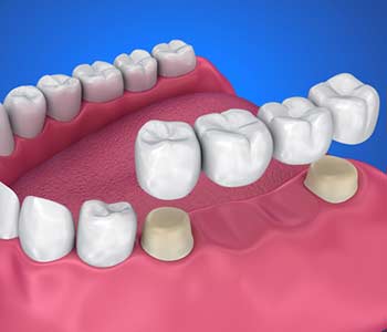 Medically accurate 3D illustration
